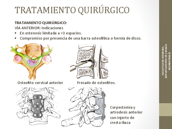 docencia/facultad_medicina/grado_medicina/practicas-urologia-grado/mielopatia